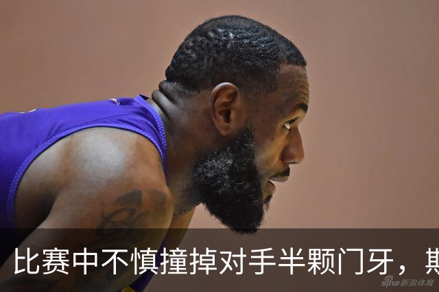 比赛中不慎撞掉对手半颗门牙，斯图加特中场哈努斯赛后道歉